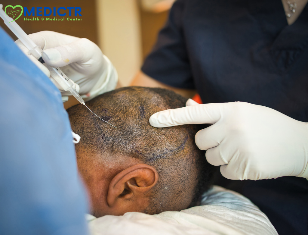 What Is Hair Transplantation And How Is It Done?